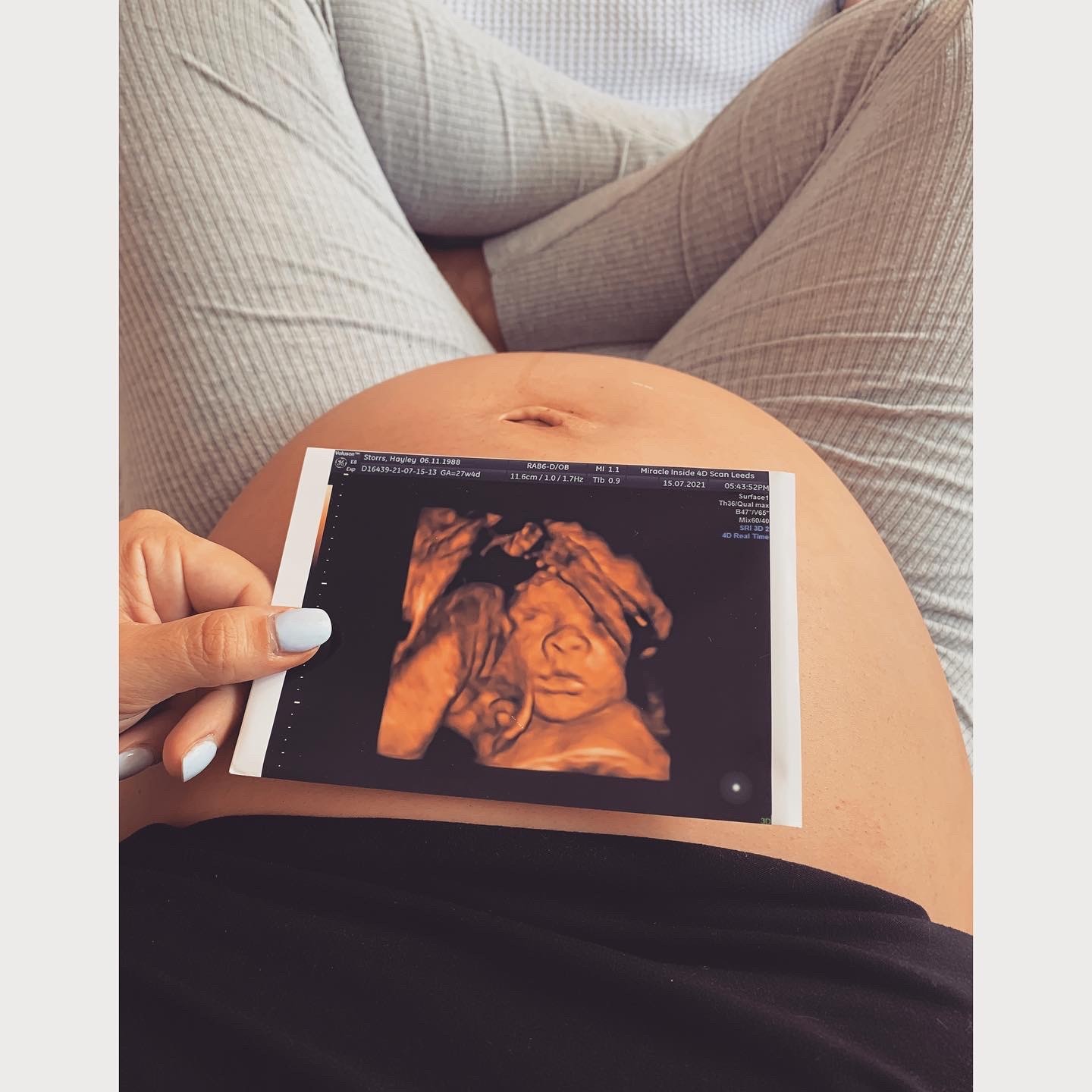 4D scan of a baby