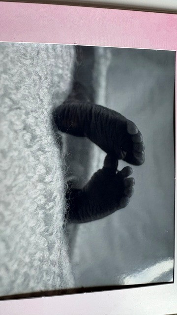 Esme was a second trimester loss feet.