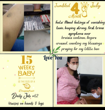 Parthavi had to have daily injections on her journey to her rainbow baby.