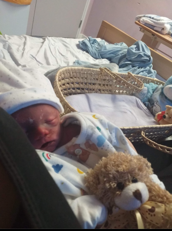 Chelsea’s son who died as a result of a placental abruption. One of four placental abruptions his mum had.
