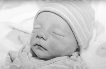  Another of Chelsea’s sons who died as a result of a placental abruption. One of four placental abruptions his mum had 