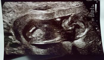 A scan of baby Ibraheem who was a second trimester loss at just over 18 weeks.