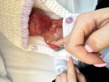 Sienna who was born at 19 weeks and a second trimester loss.
