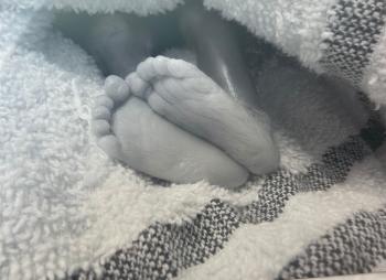 Sage’s feet after he was born at 22 weeks in what was labelled a miscarriage
