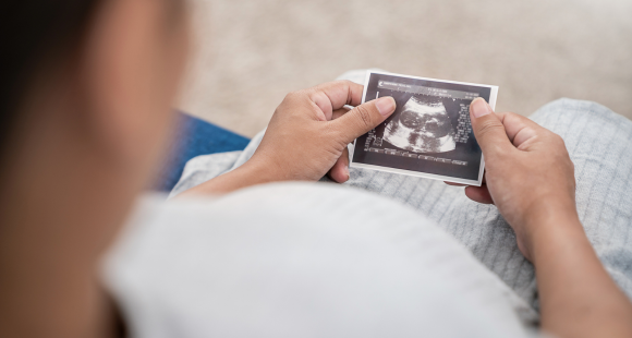 Person in hospital gown sits, holding baby scan. Sands logo is in top right corner.