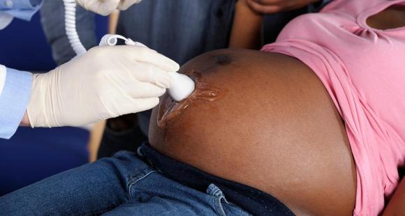 Woman receiving ultrasound examination.