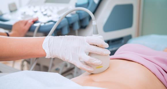 pregnant woman having a scan
